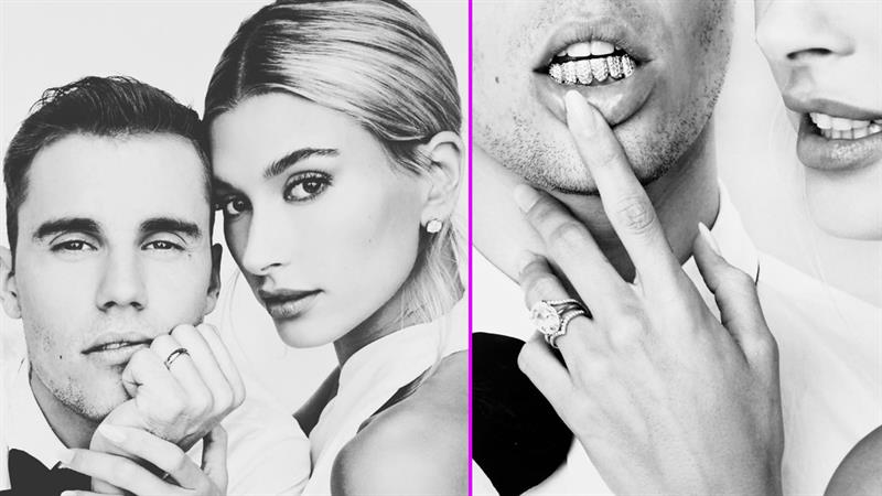 Justin Bieber Sports A Blinged Out Grill At His Wedding To Hailey Baldwin Access Mainkan game online justin bieber perfect teeth gratis di y8.com!