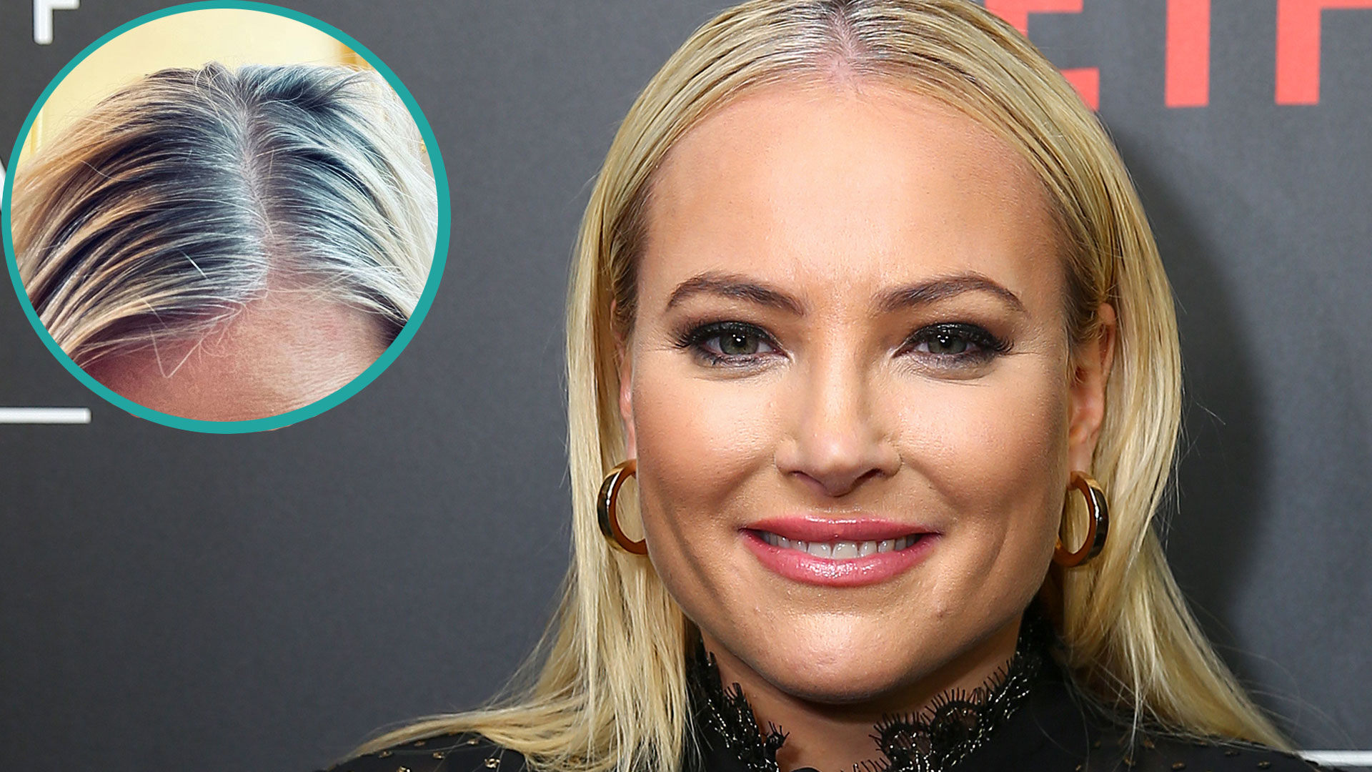 Meghan McCain Admits Hair Went Prematurely Gray In Her 20s 'I'm Owning